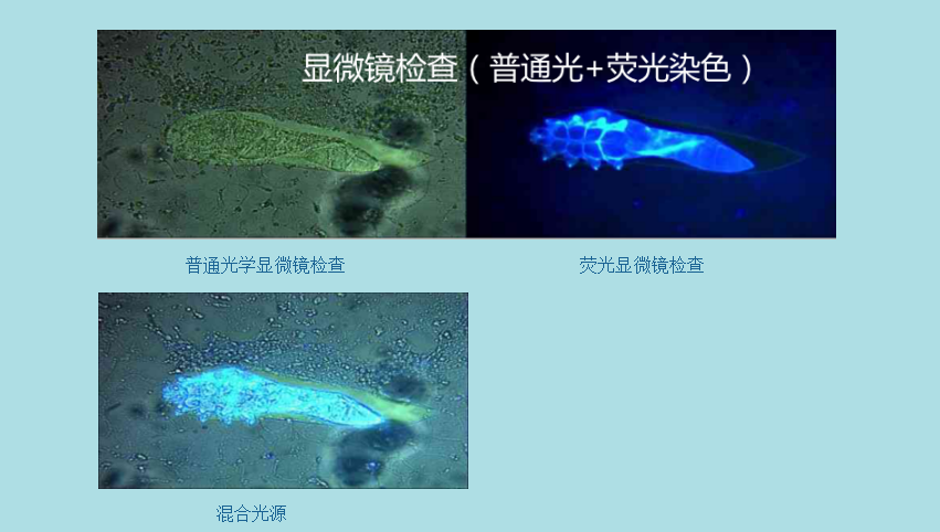 真菌荧光染色和KOH染色效果对比图