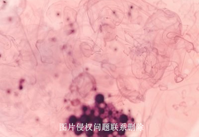 真菌荧光染色液厂家介绍真菌荧光染色检查大概多久出结果？
