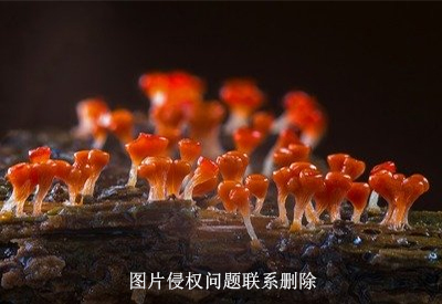 真菌荧光染色检测方法与以往检验科应用的湿片检测法相比有三大优势