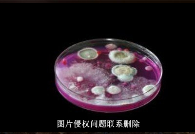 真菌染色液荧光染色生产厂家介绍真菌三项检查包括哪些？