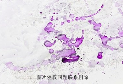 真菌荧光染色液原理检测介绍真菌荧光染色诊断技术怎么做？