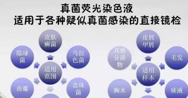 新品推出检验科真菌荧光染色液荧光染色新技术