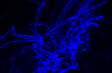妇科阴道微生物真菌荧光染色剂免疫荧光微生物检测 