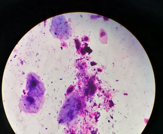 真菌荧光染色液在真菌镜检中的应用在荧光显微镜下定性检测真菌