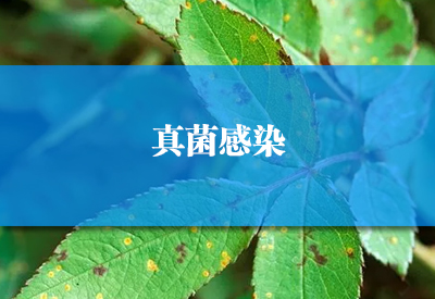 真菌荧光染色液品牌:比传统直接镜检法阳性检出率高,真菌菌丝无处遁形! 真菌荧光染色液品牌:比传统直接镜检法阳性检出率高,真菌菌丝无处遁形!