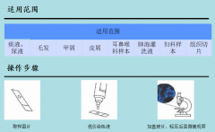 真菌荧光染色液是如何检测真菌的呢?