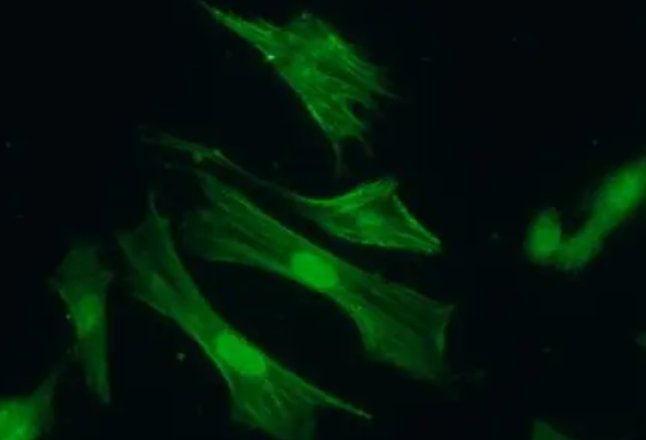 中仁真菌染色液厂家介绍:多细胞真菌常用的染色方法GK10.22