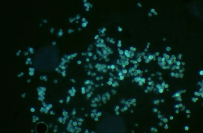 河南洛阳真菌荧光染色剂厂家介绍真菌感染的三个原因11.24
