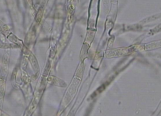 真菌荧光染色液厂家介绍真菌荧光和镜检的区别荧光染色法与KOH法的效果比较