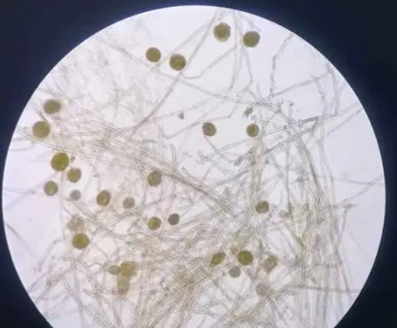河南安阳真菌荧光染色试剂介绍常见的真菌形态,真菌的基本结构