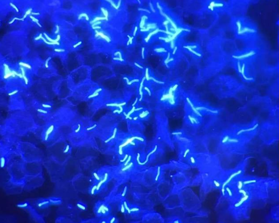 2022真菌荧光染色剂厂家新款真菌染色剂有哪些优点,荧光染色剂的检测方法