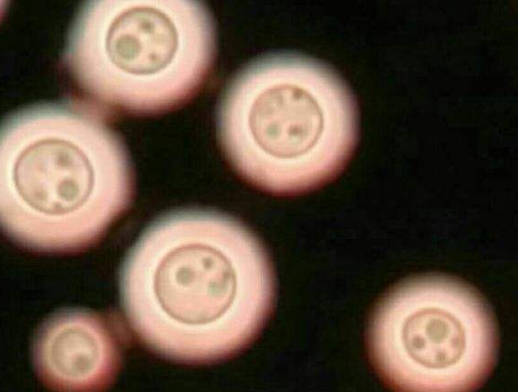 河南漯河真菌荧光染色剂厂家ZR:真菌在显微镜下的各种大致形态