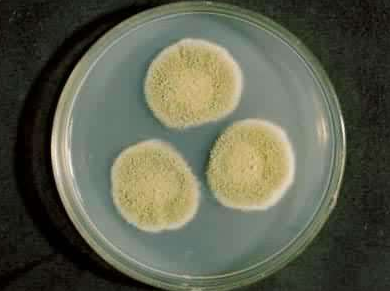 河南新乡真菌荧光染色试剂厂家:培养细菌和真菌的一般方法,培养的意义