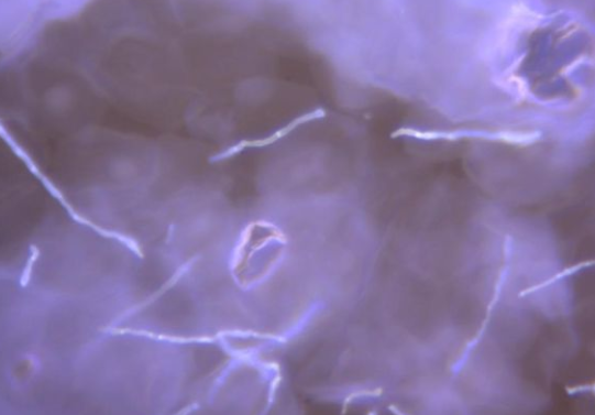 2022新型真菌染色液有害吗,相对于直接镜检的优势在哪里-中仁医学