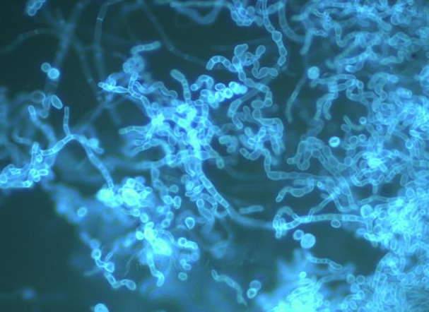 2022新型真菌染色液有害吗,相对于直接镜检的优势在哪里-中仁医学